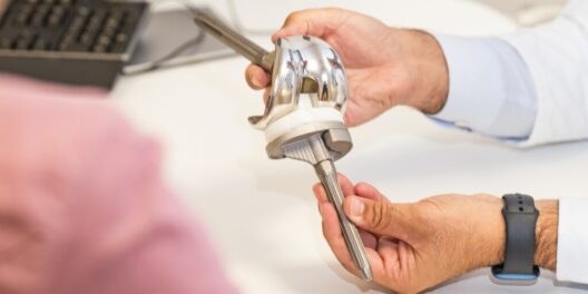 A,traumatologist,showing,a,knee,prosthesis,to,a,patient,during